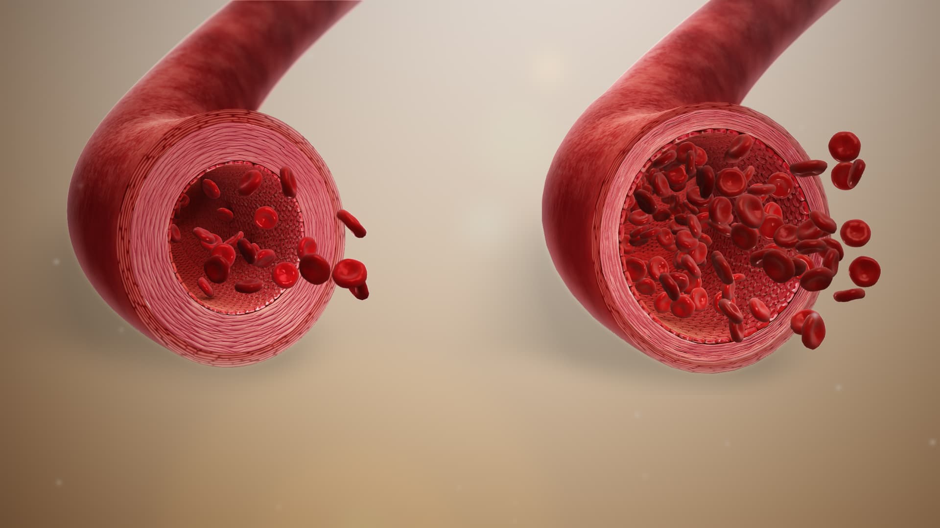 Example of Vasodilation 